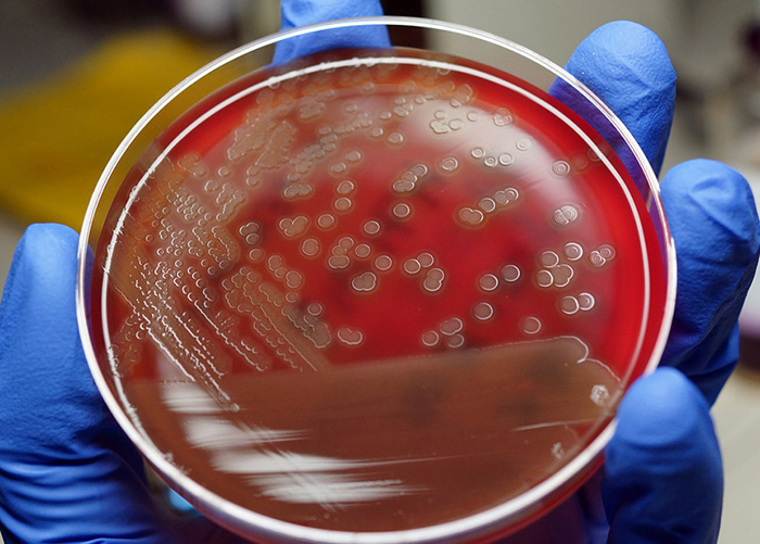 vi khuẩn Pseudomonas spp trên cá