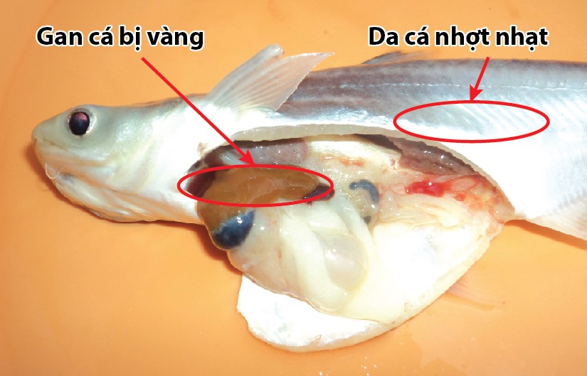 Triệu chứng bệnh lý