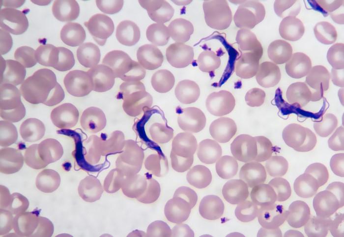 Trùng roi (Trypanosoma)