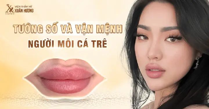 Môi Cá Trê Là Gì? Đặc Điểm, Ý Nghĩa Tướng Số Và Cách Cải Thiện