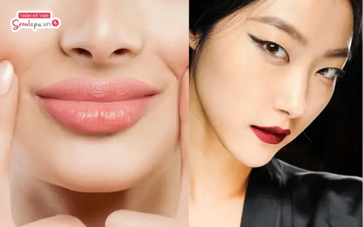 Môi Cá Trê Là Gì? Đặc Điểm, Ý Nghĩa Tướng Số Và Cách Cải Thiện