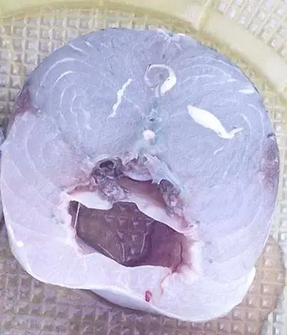 Sán Trong Cá Biển: Nguyên Nhân, Dấu Hiệu Nhận Biết Và Cách Phòng Tránh Nhiễm Sán
